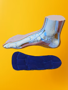 Anatomisches Fußmodell über einer blauen sensomotorischen Einlage.