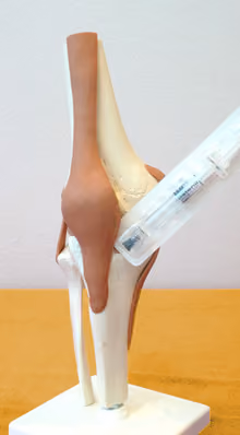 Anatomisches Kniemodell auf einem Ständer, daneben eine Spritze.