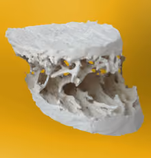 Modell eines Knochenquerschnitts mit poröser Knochenstruktur.